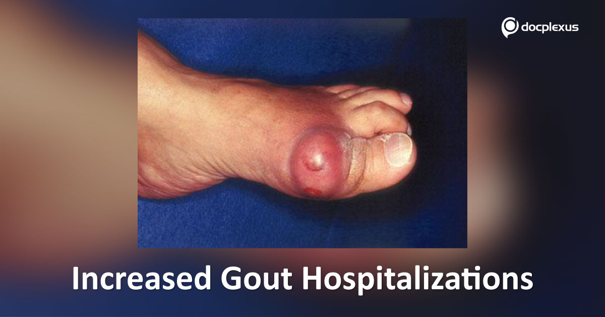 Gout, Need For Increased Recognition