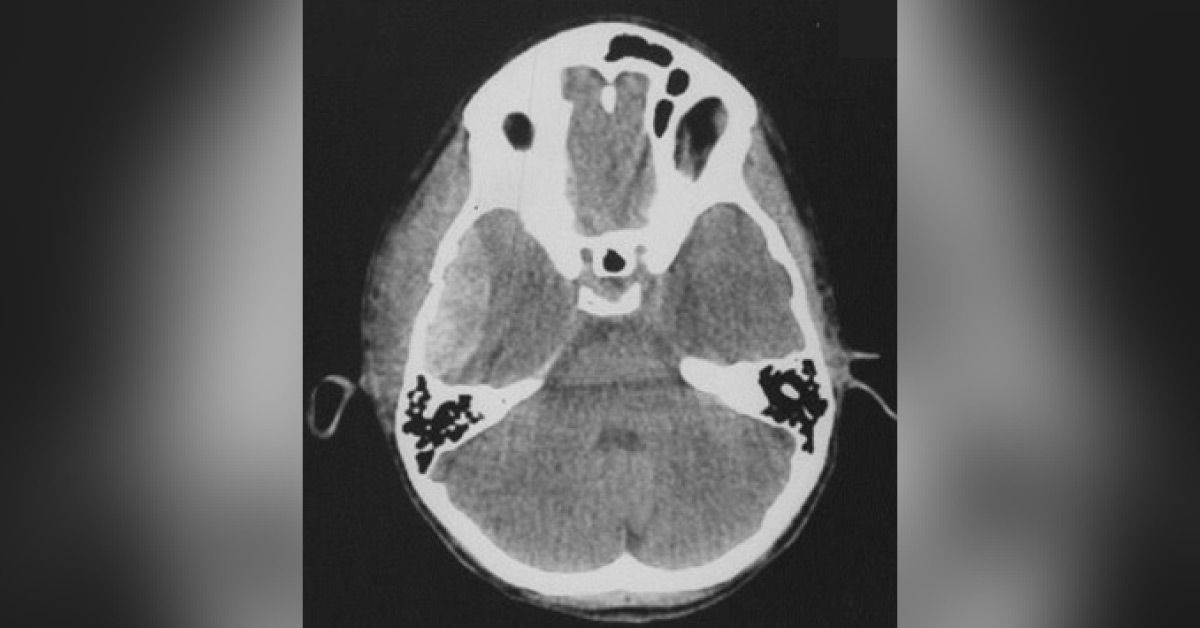 Interpret These Radiologic Findings