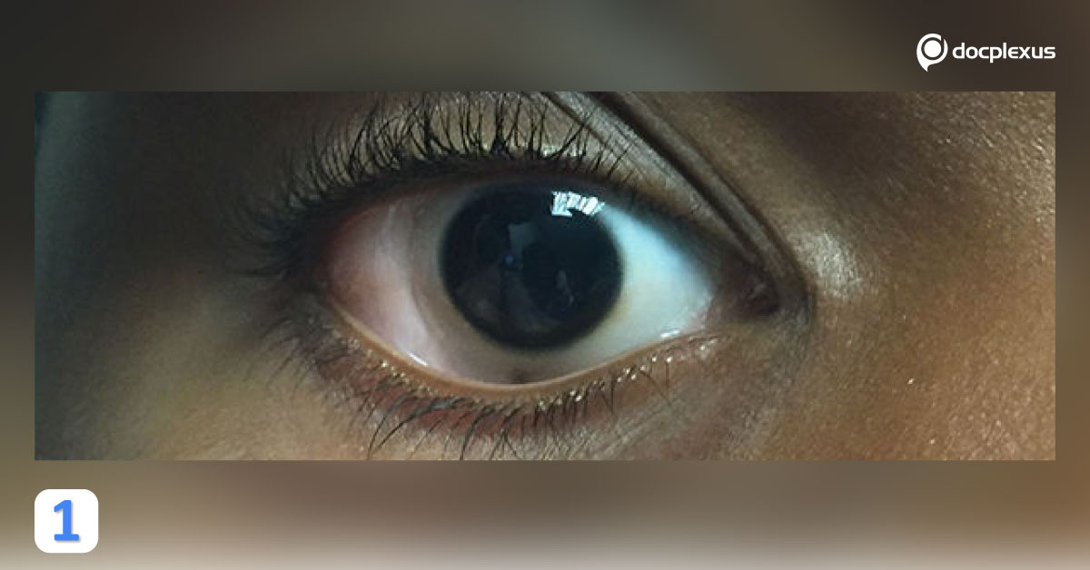 What Is This Abnormal Growth?