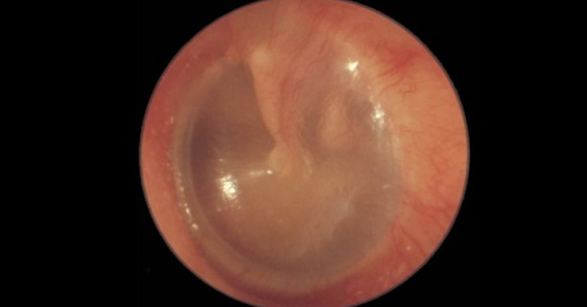 Resolve This ENT Case