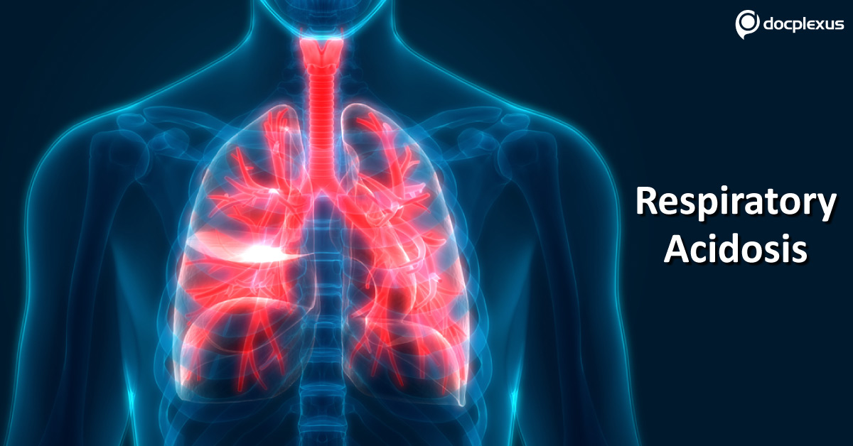 Respiratory Acidosis, Essential Diagnostic Measures