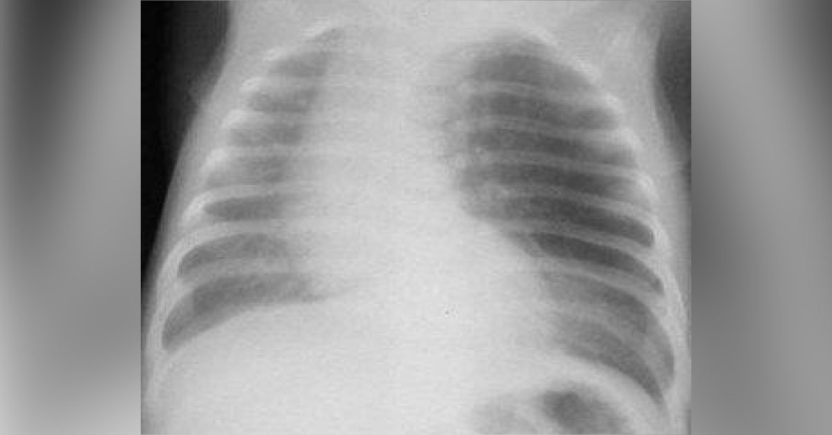 Identify the Congenital Abnormality