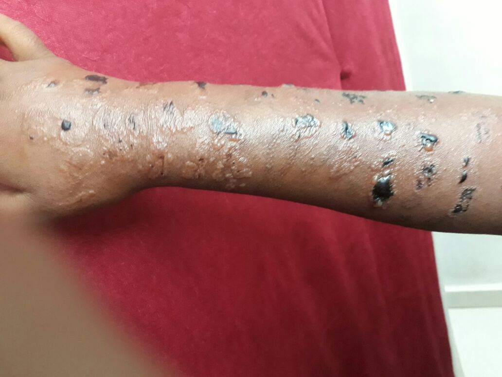 Diagnose The Case Of Itchy Face