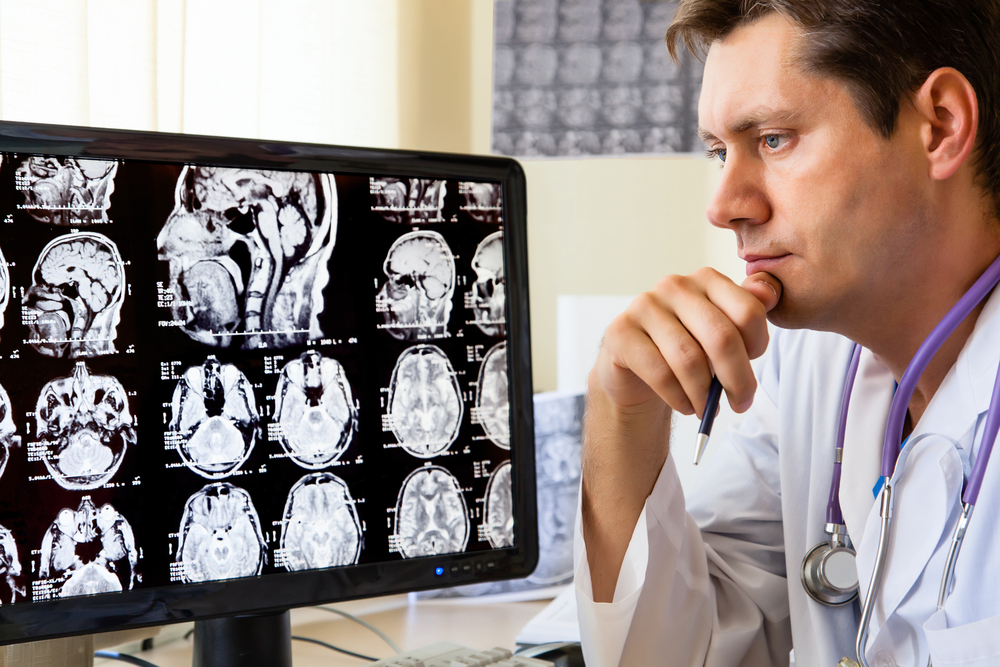 Neurons Control Human Habbits, No More Acquired Psychological Problem
