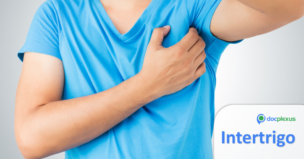 Diagnosis and Management Of Intertrigo