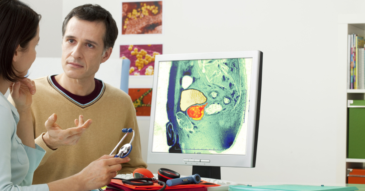 Does Vasectomy Increase Risk Of Prostate Cancer?