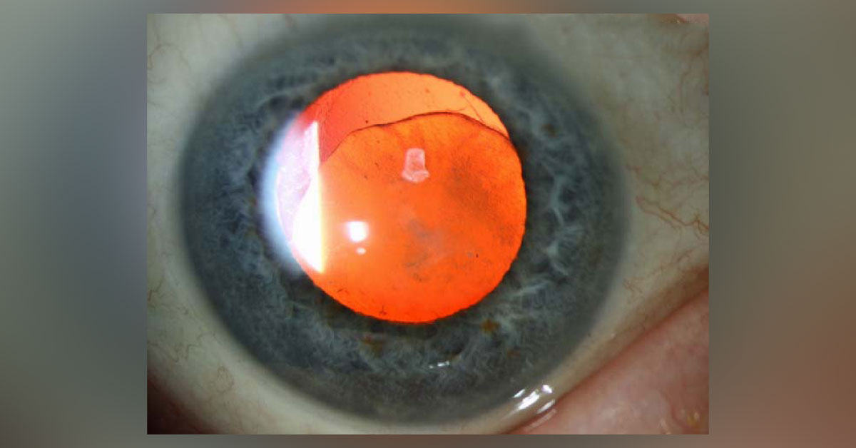 What Is This Condition?