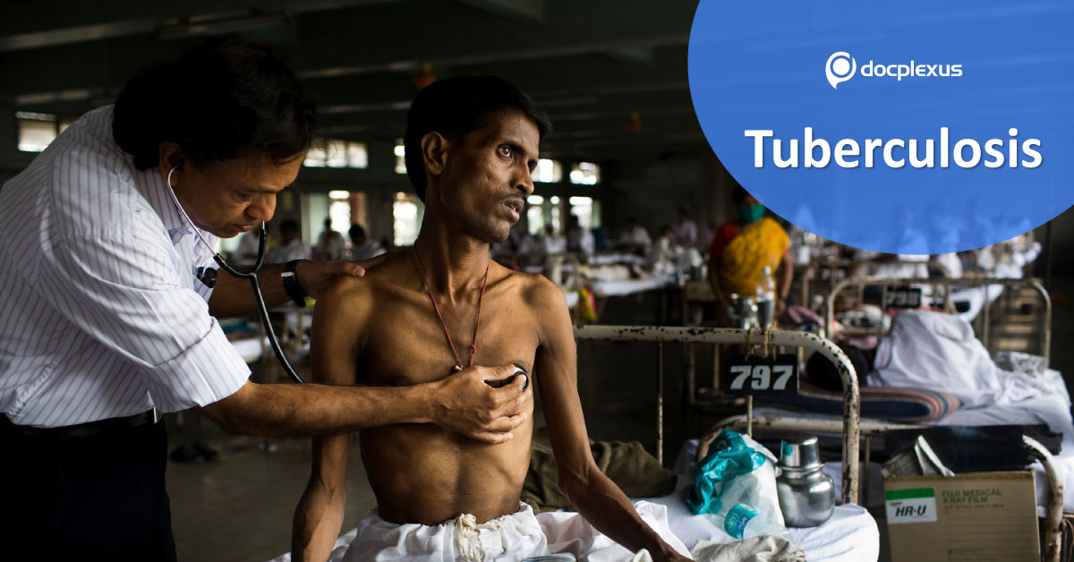Adding Moxifloxacin For Better Outcomes In TB