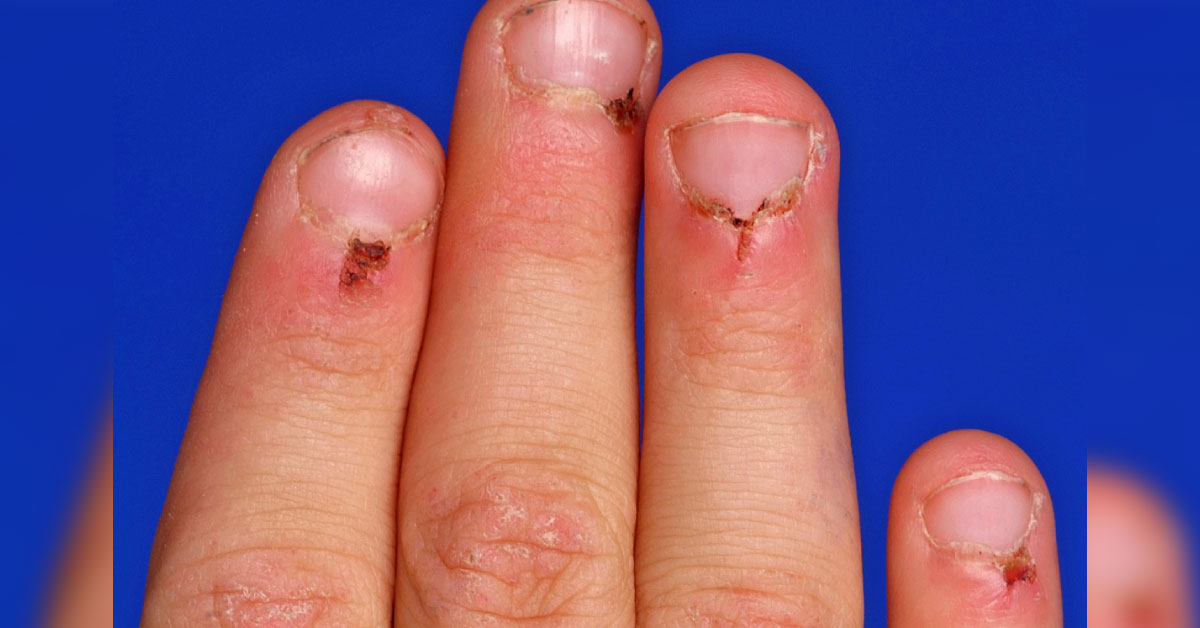 Diagnose The Condition In This 8 Year Old Boy