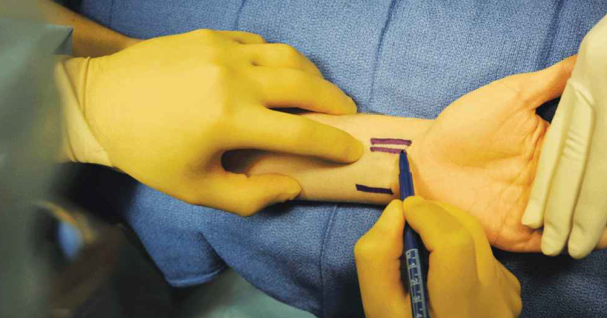 Wrist Block, An Overview