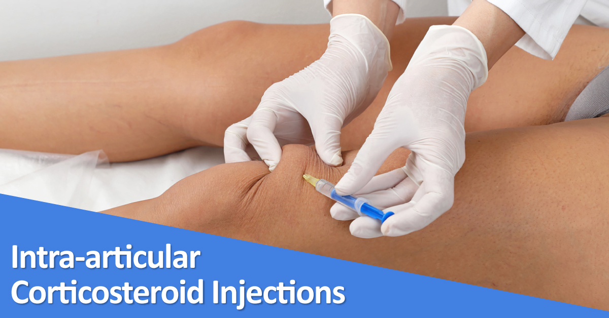 Evaluating Efficacy Of Intra-articular Corticosteroid Injections