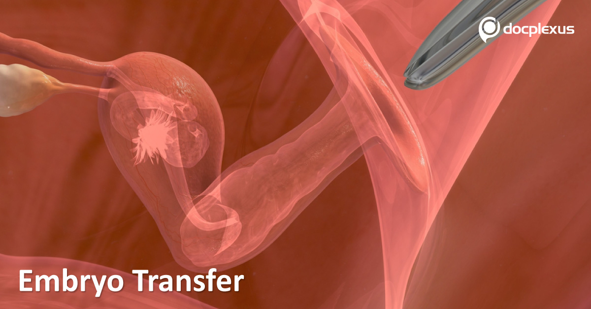 Can Embryo Transfer Affect The Results Of IVF and ICSI?