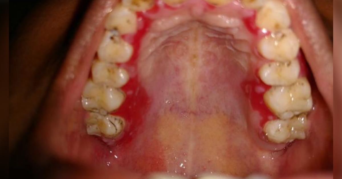 Identify This Lesion