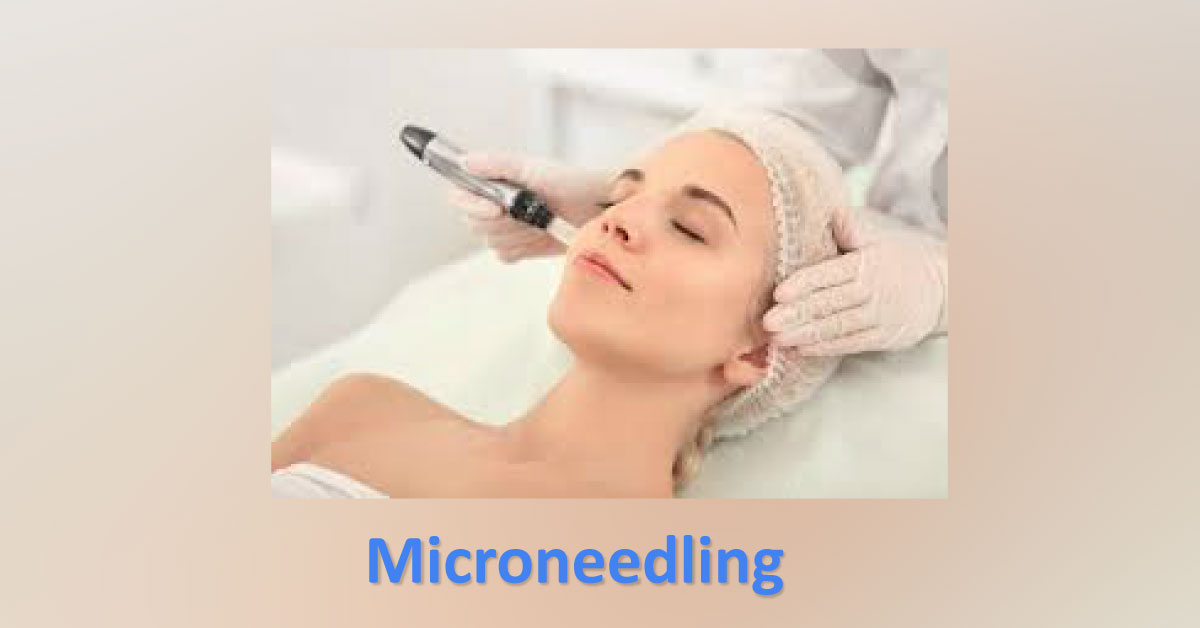 Microneedling: Applications In Dermatology