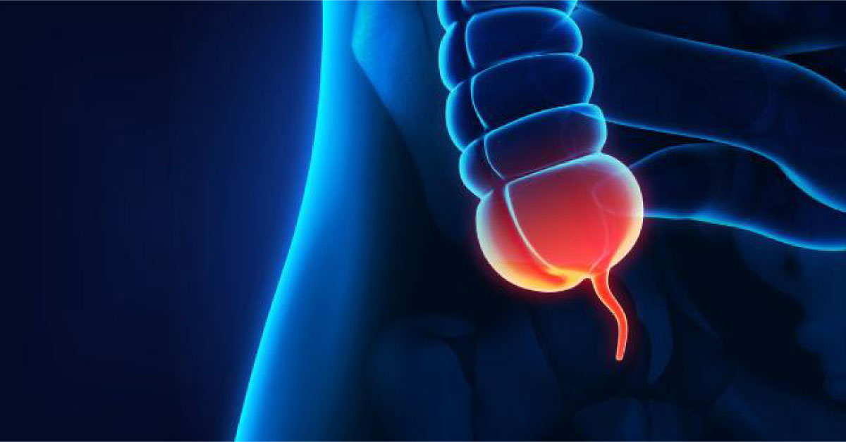 Non Operative Treatment Of Acute Appendicitis