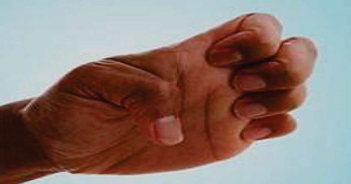 Primary Dystonias: Recommendations for Diagnosis