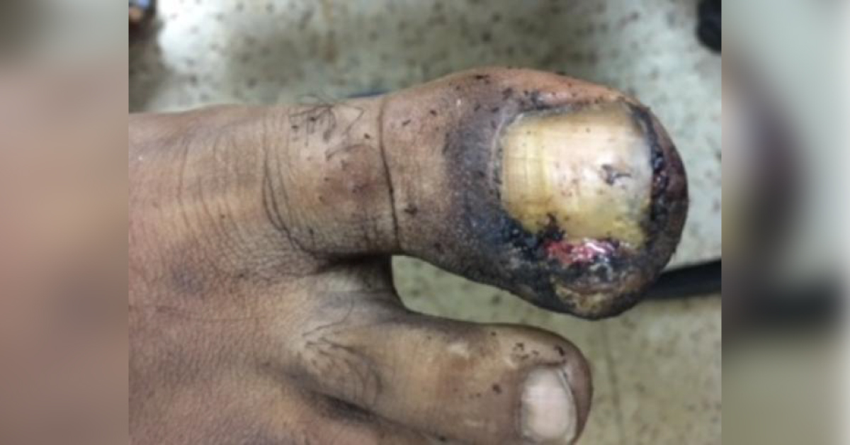 Identify This Condition