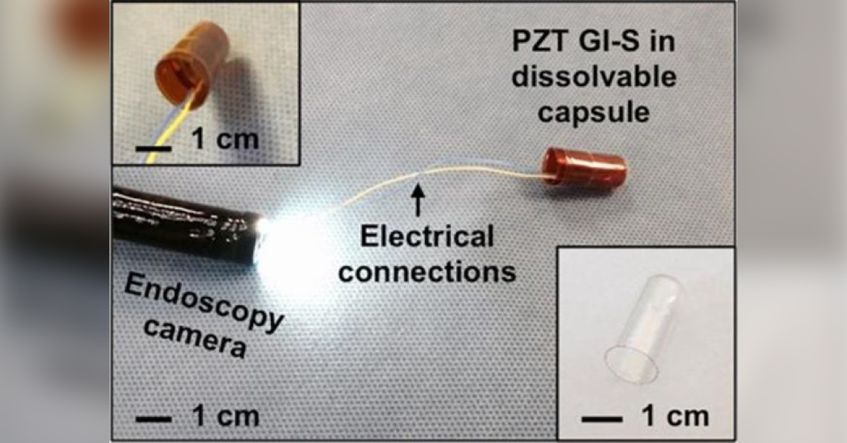 Flexible Sensors Can Detect Movement Of Food Inside Intestines
