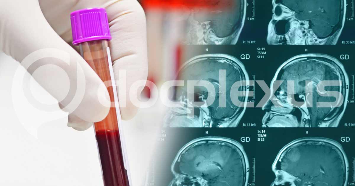 Diagnosis Workup For Traumatic Head Injury