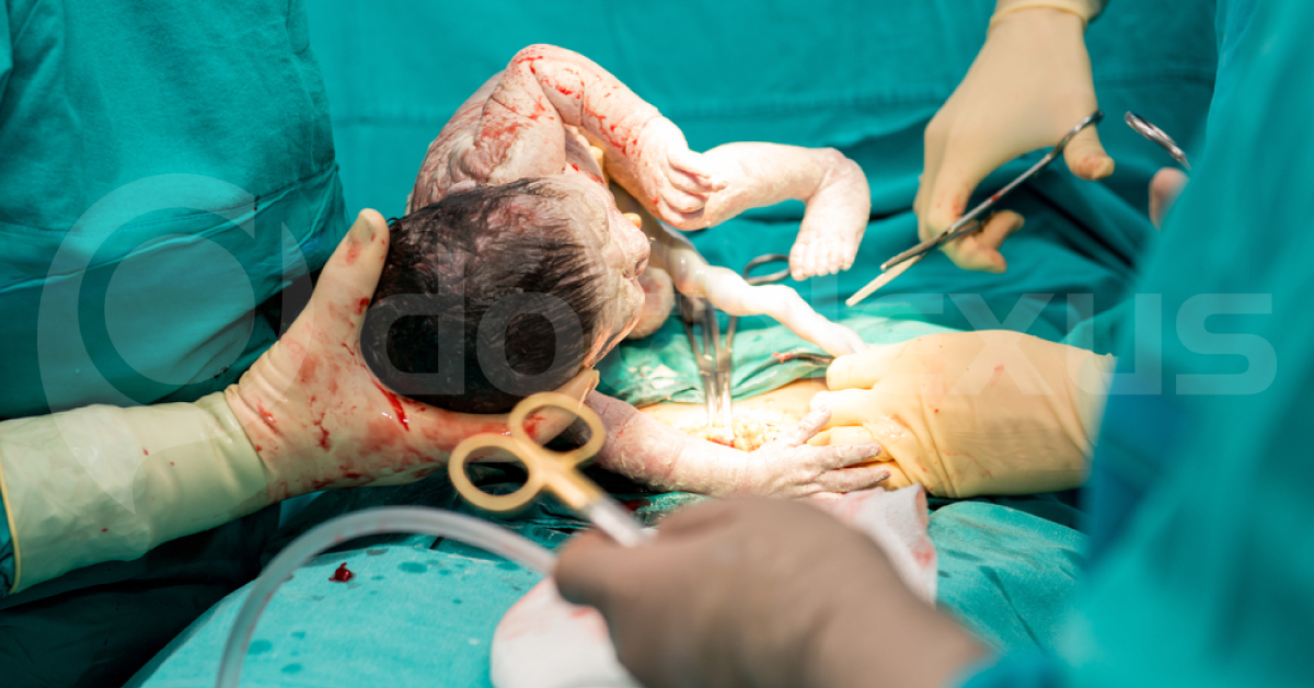 Adoption Of Robson’s Criteria For Cesarean Section In India