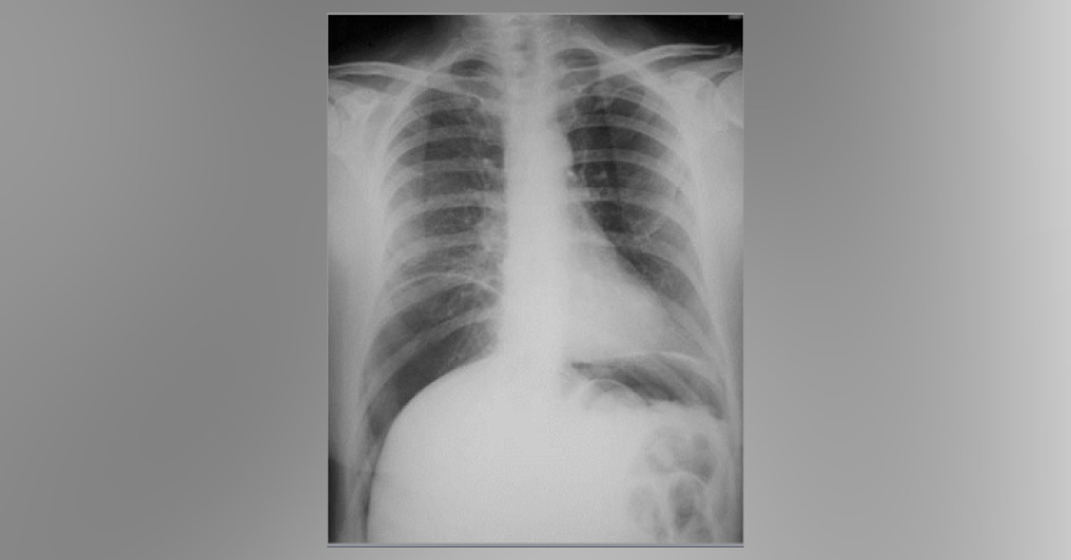 Spot The Underlying Condition