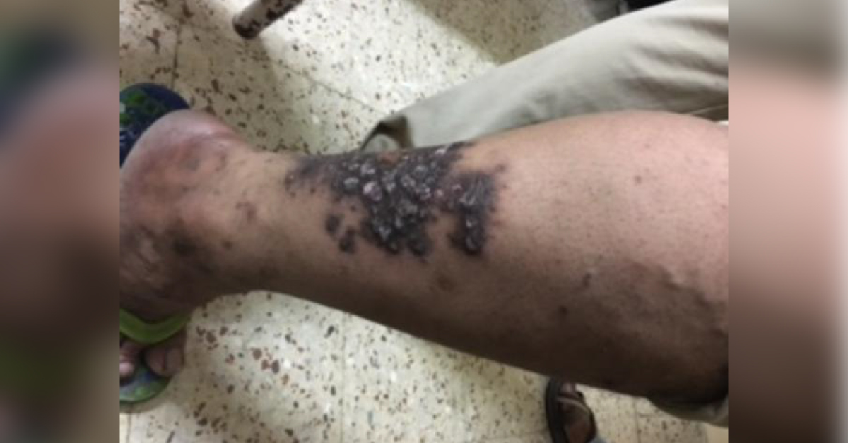 Identify This Skin Lesion