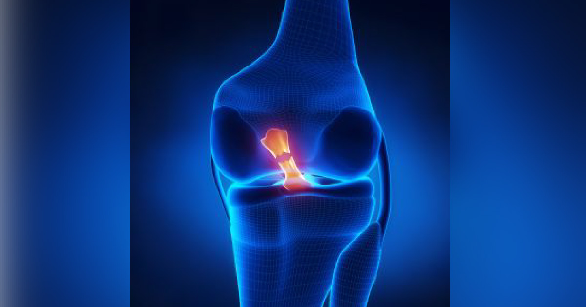 Radiological Imaging Of Anterior Cruciate Ligament