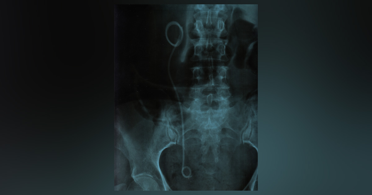 Interpret These Radiological Findings