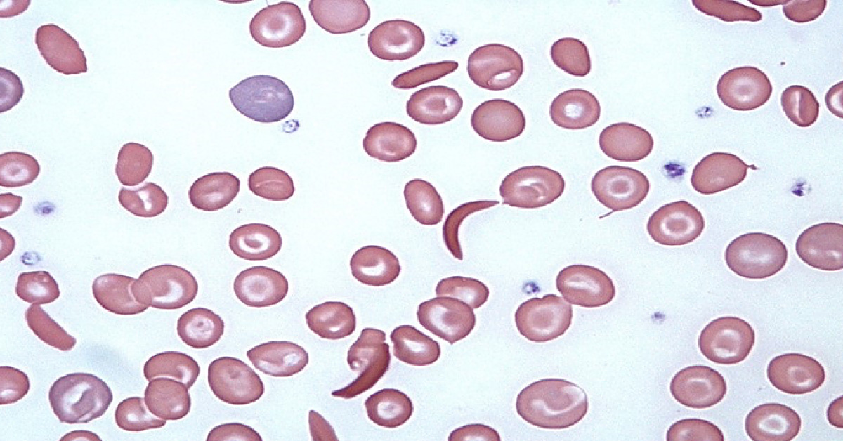 Interpret The Pathological Findings