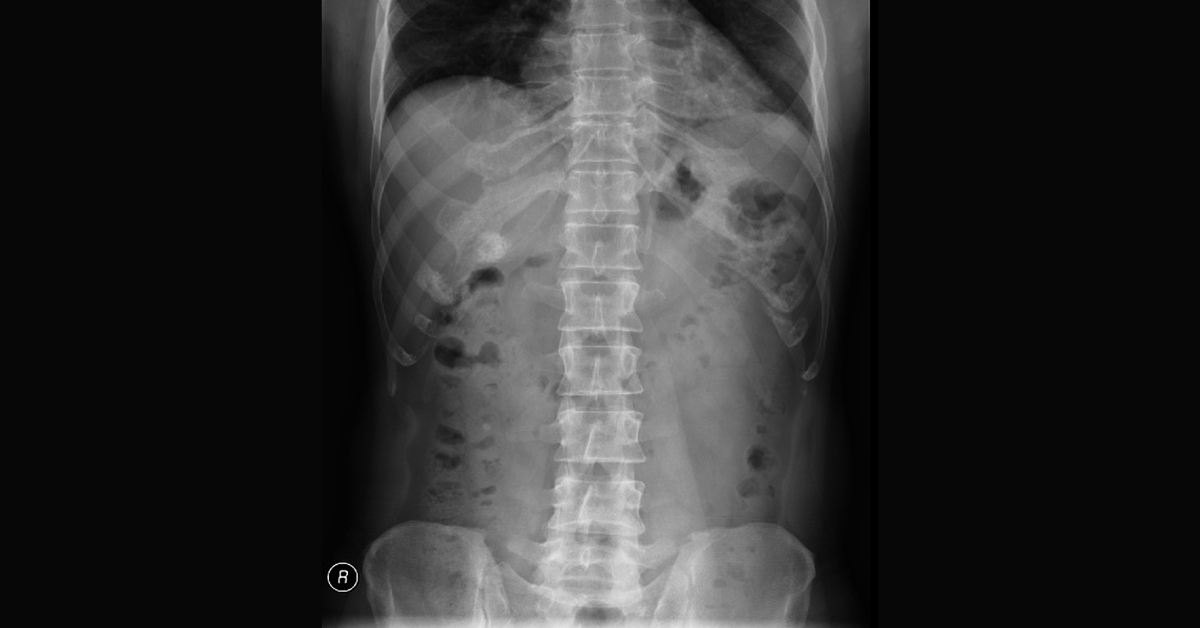 Image Based Diagnosis