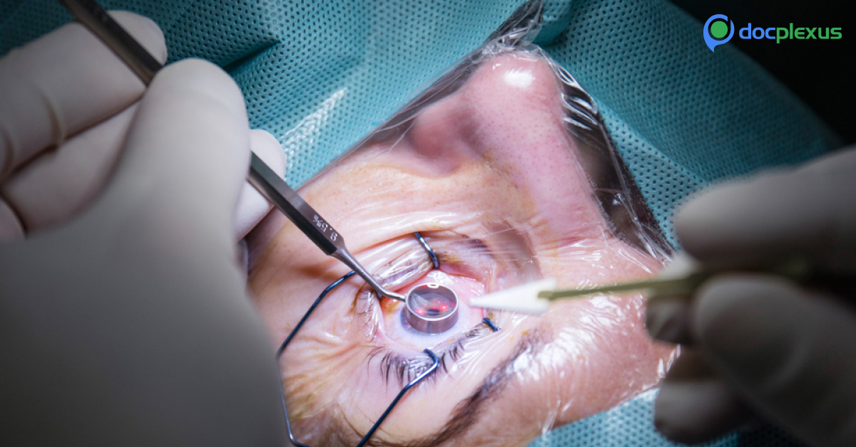 LASIK Procedure: How To Do It?