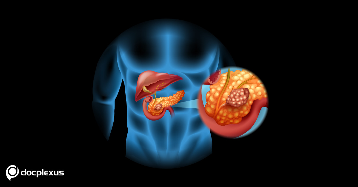 New Mechanism Of Drug Resistance In Pancreatic Cancer