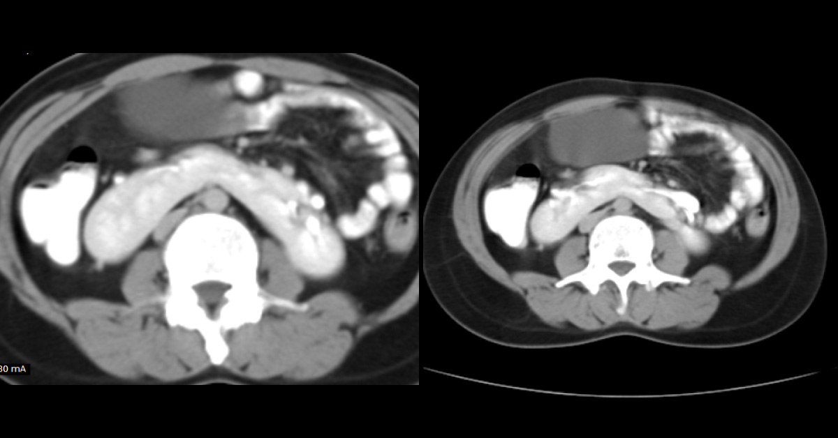 Diagnose The Nephrological Condition