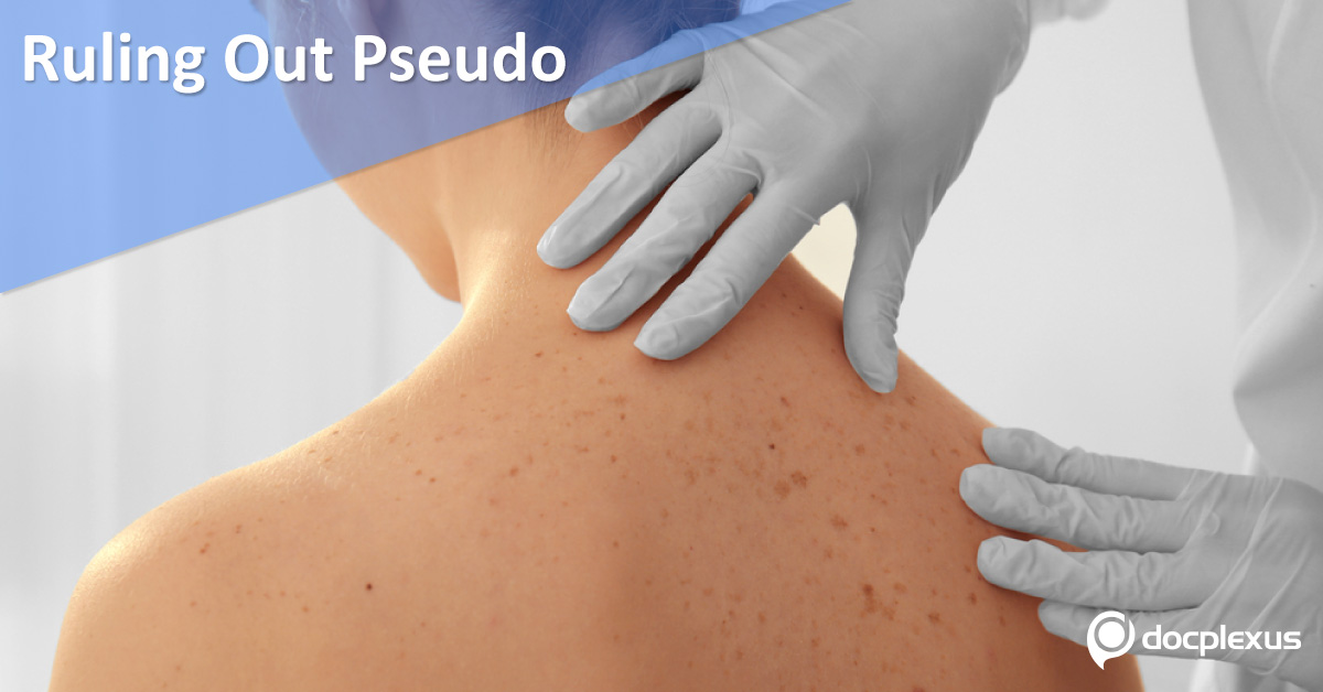 Distinguishing Pseudo From Real Dermatological Conditions