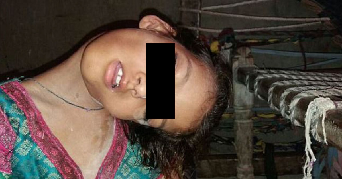 Hanging Head Girl, A Rare Muscular Disorder Yet To Be Named