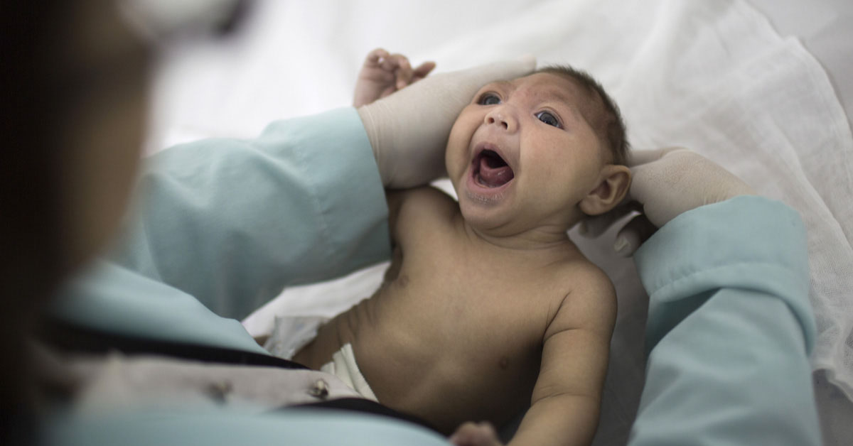 Guidance On Management Of Infants With Congenital Zika