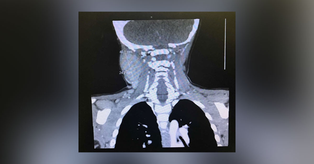 What Is Growing In His Neck?