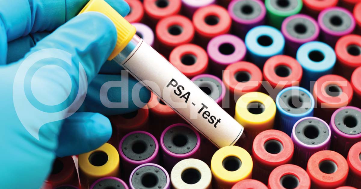 7 Causes Of High PSA Levels, But They Are Not Cancer