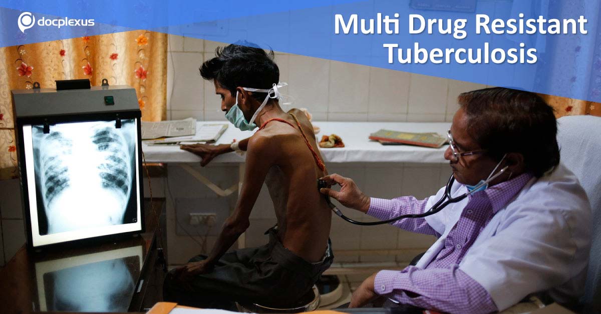 Health Ministry Approves New Drug For MDR-TB