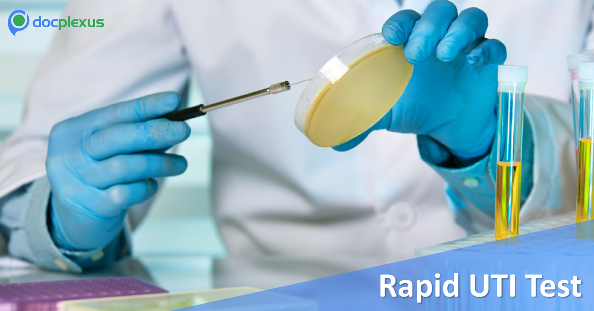 Rapid And Cheap UTI Test Developed