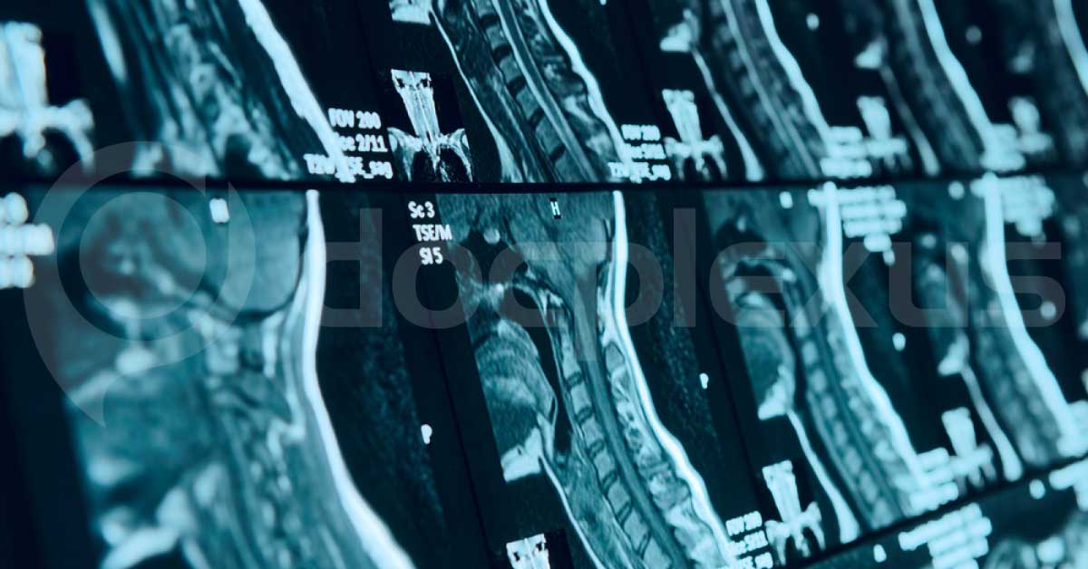 Diffusion Tensor Imaging For Diagnosis Of Spinal Cord Pathology