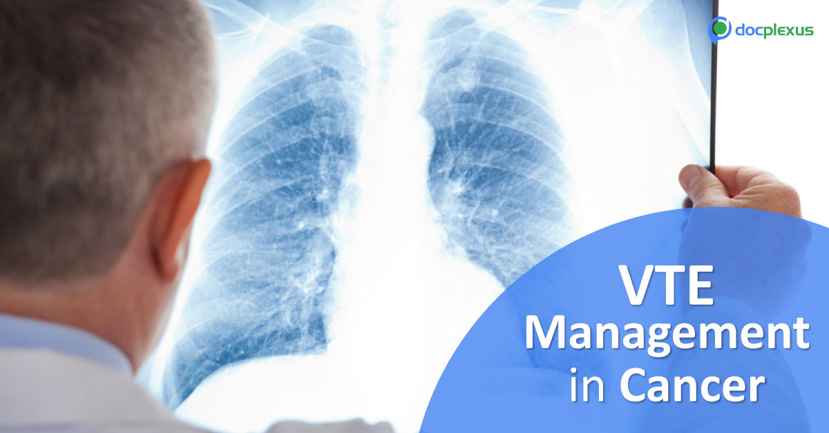 Management Of Venous Thromboembolism In Cancer Patients
