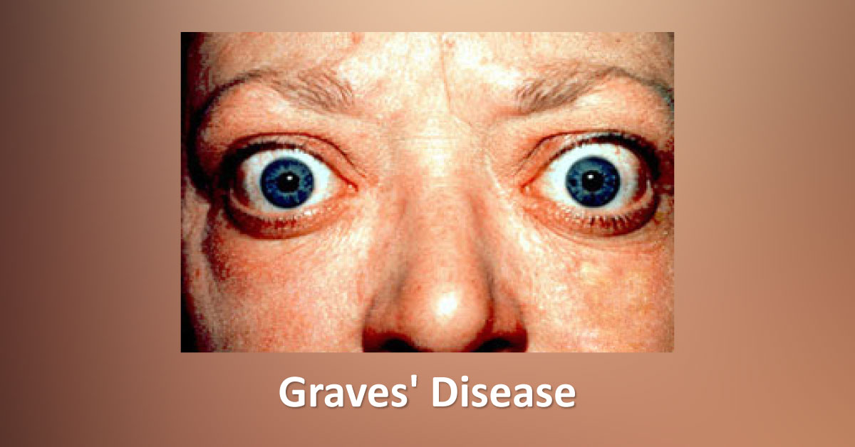 How Will You Treat This Patient