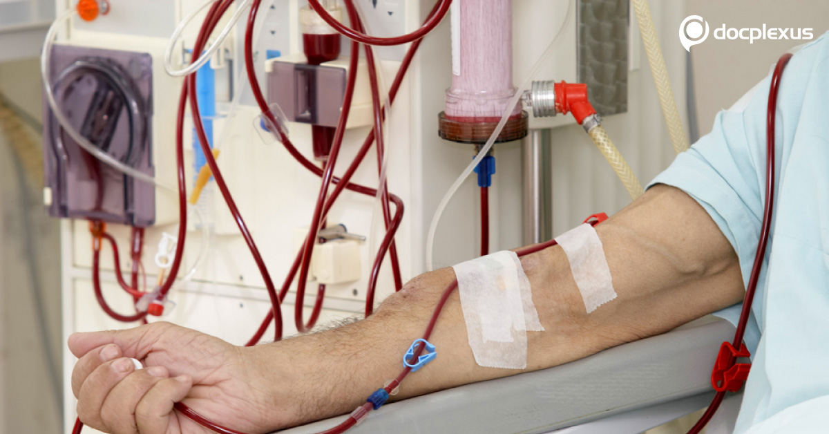Managing Dialysis Patients During Surgeries