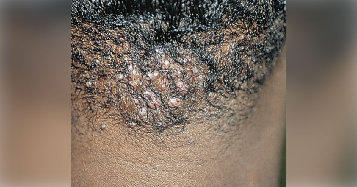 Spot The Dermatological Condition