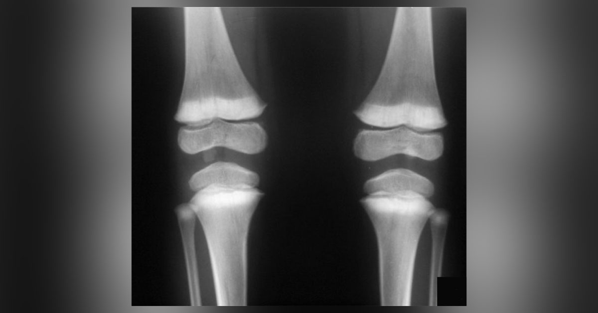 Interpret The Radiograph