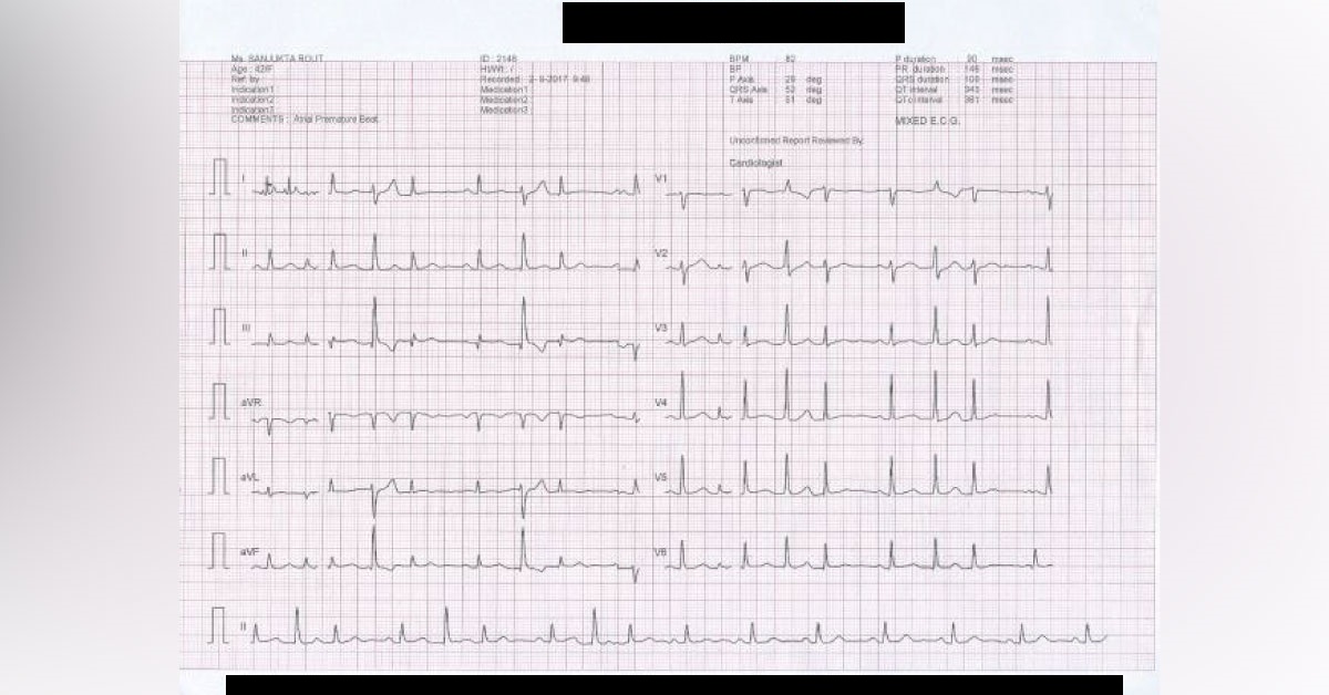 Diagnose The Rhythm