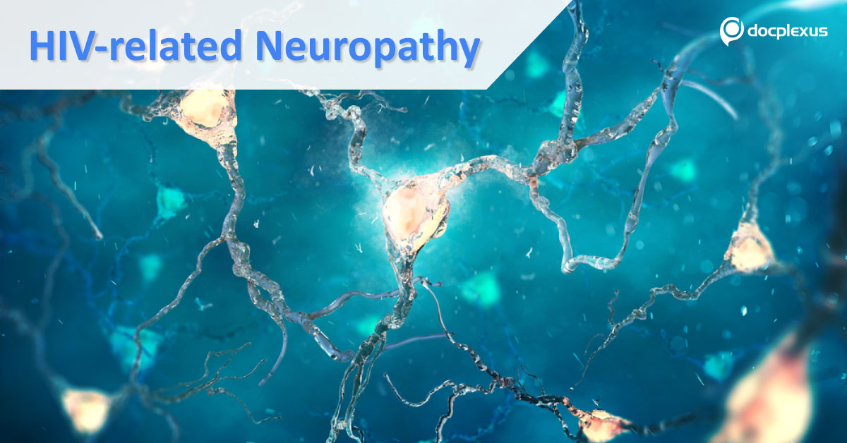 Managing Neuropathy In HIV Setting