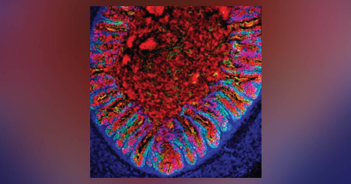 Lab-grown Human Colons Change Diagnosis And Treatment Of GI Disease