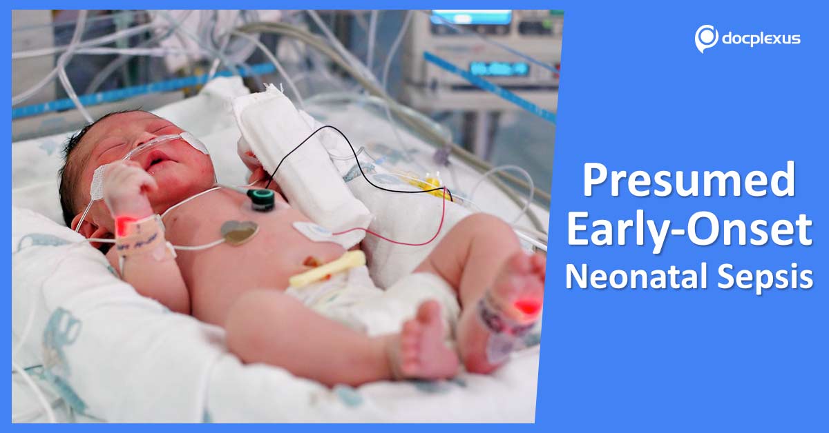 Antibiotics For Presumed Early-Onset Neonatal Sepsis